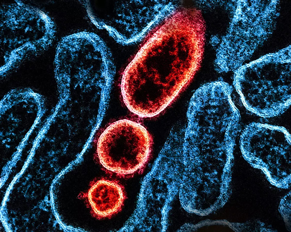 北京紅立方機(jī)場(chǎng)急救箱,交通急救箱,急救止血繃帶,急救包扎包,旋壓式止血帶等新聞資訊
